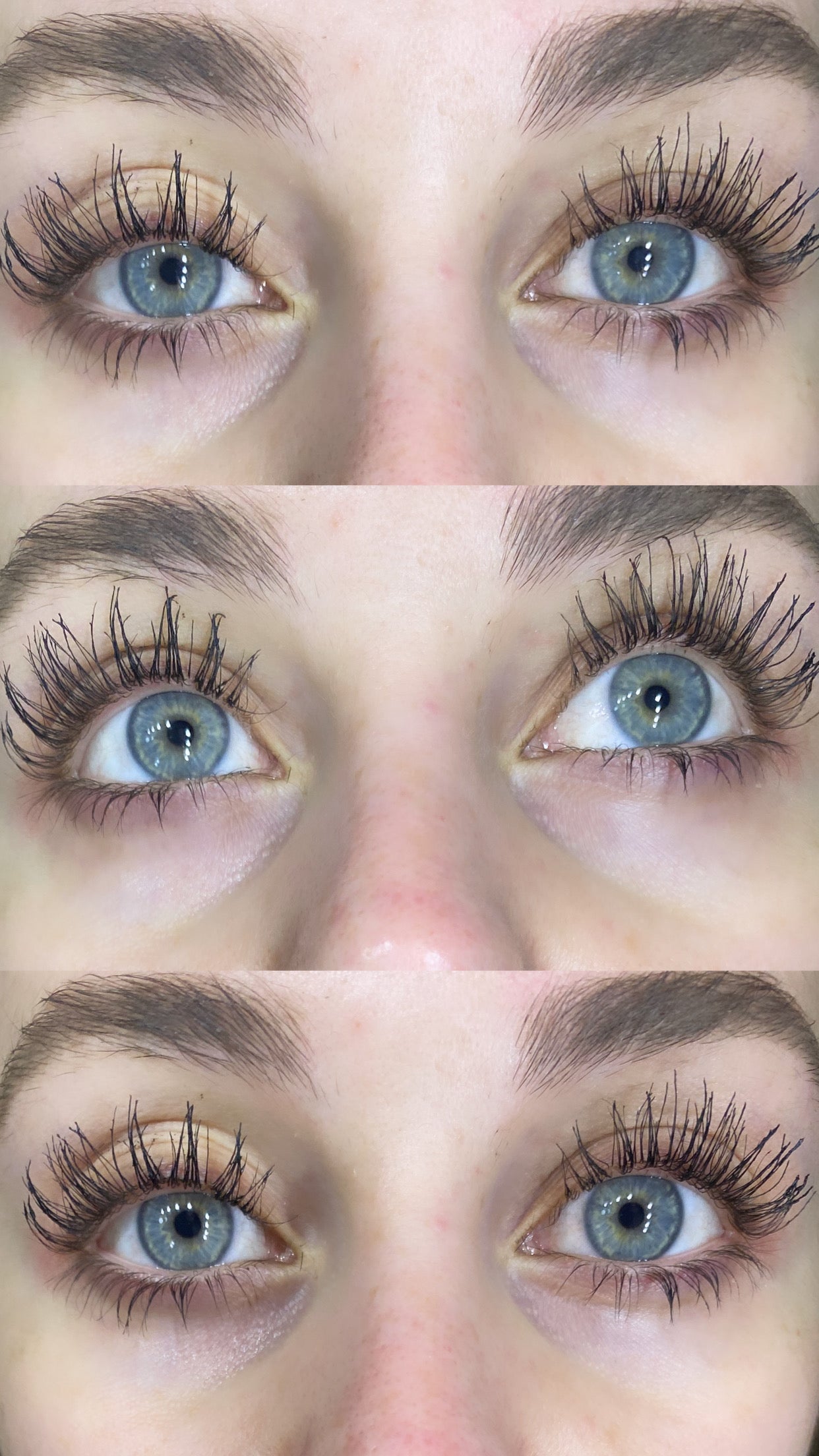 WIMPERSERUM