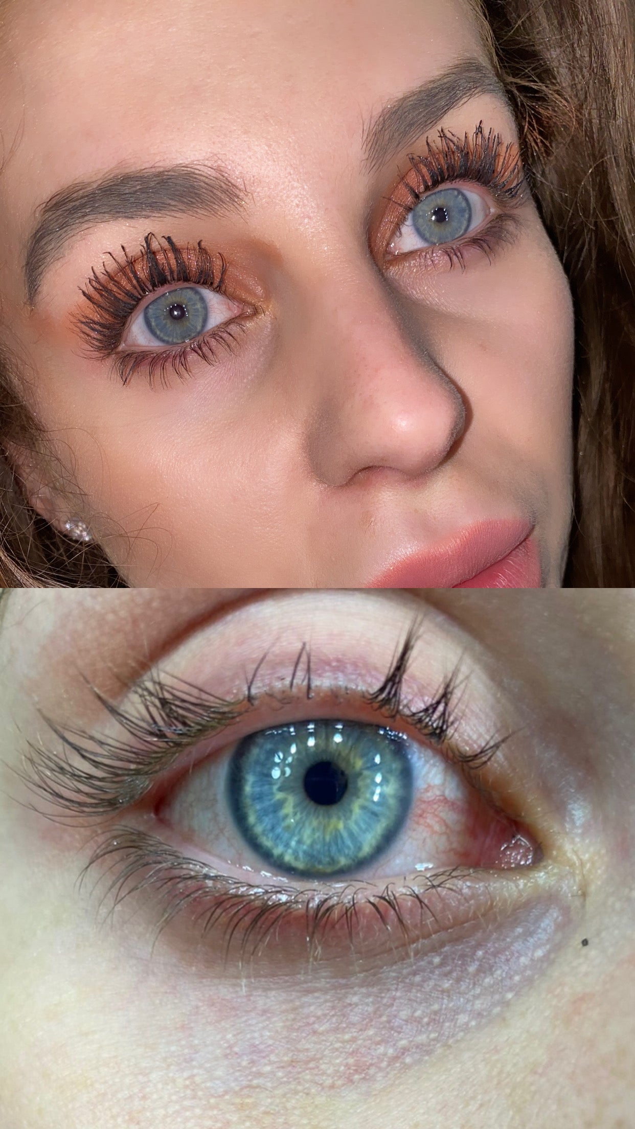 WIMPERSERUM