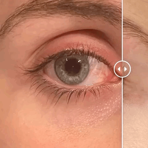 WIMPERSERUM