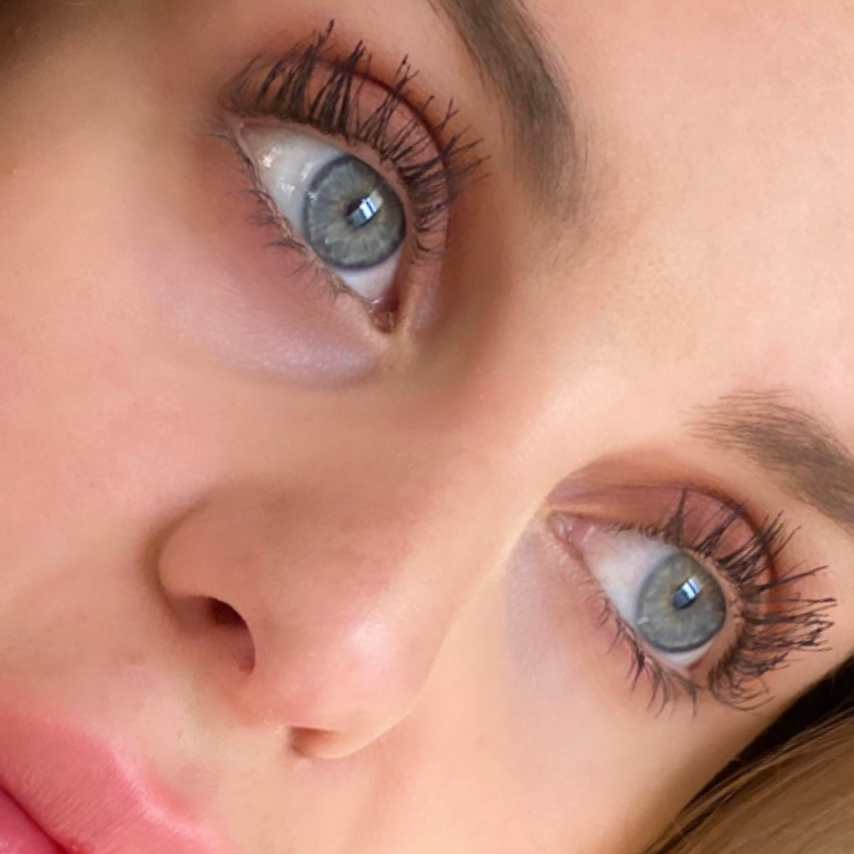 WIMPERSERUM