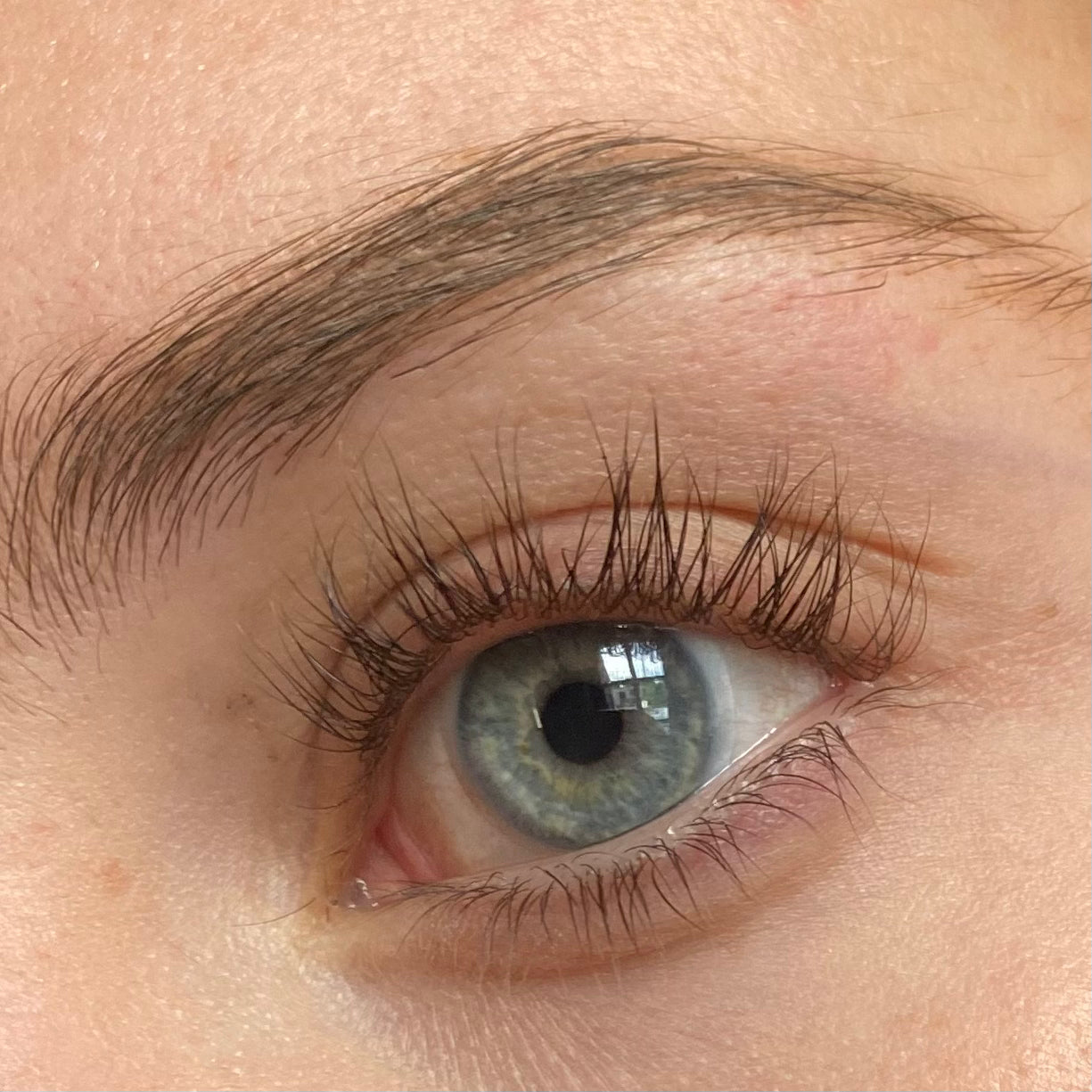 WIMPERSERUM