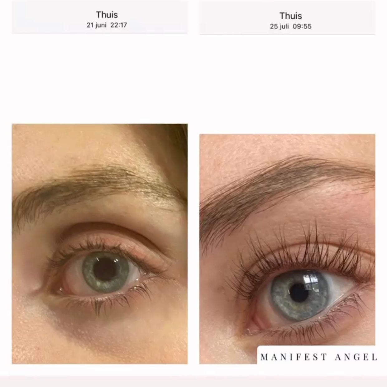 WIMPERSERUM