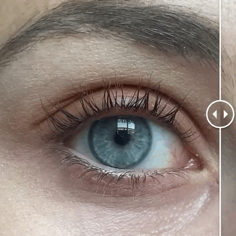 WIMPERSERUM